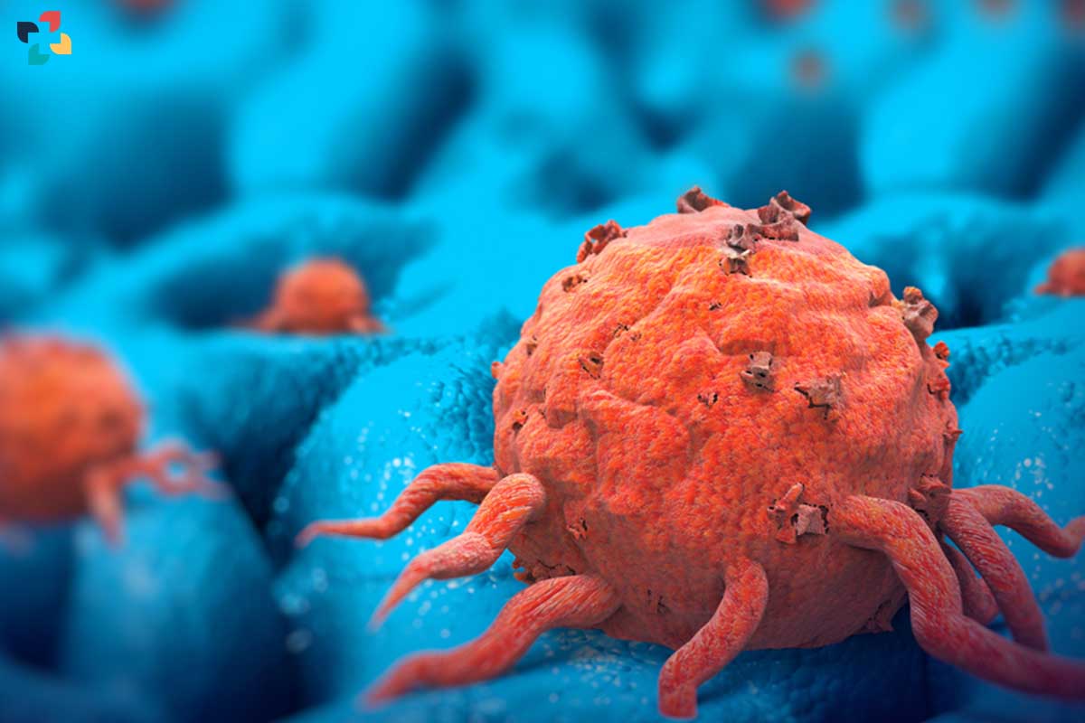Can We Expect a Cure for Cancer in 2023? | The Lifesciences Magazine