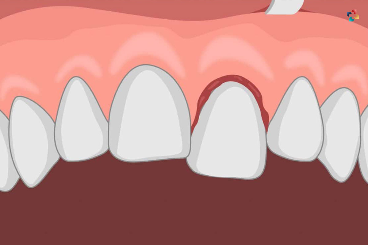 11 Basic Causes of Tooth Pain and What to Do About It | The Lifesciences Magazine