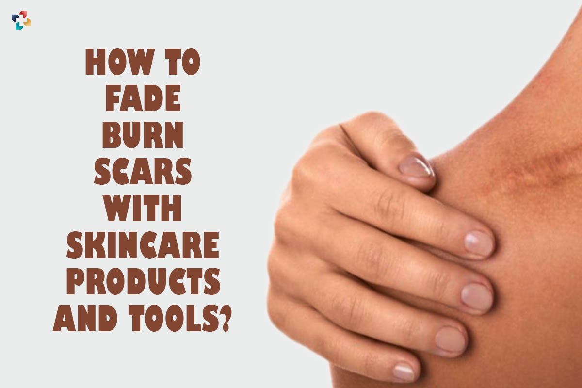 6 Best ways to fade Burn Scars with Skincare Products and Tools? | The Lifesciences Magazine