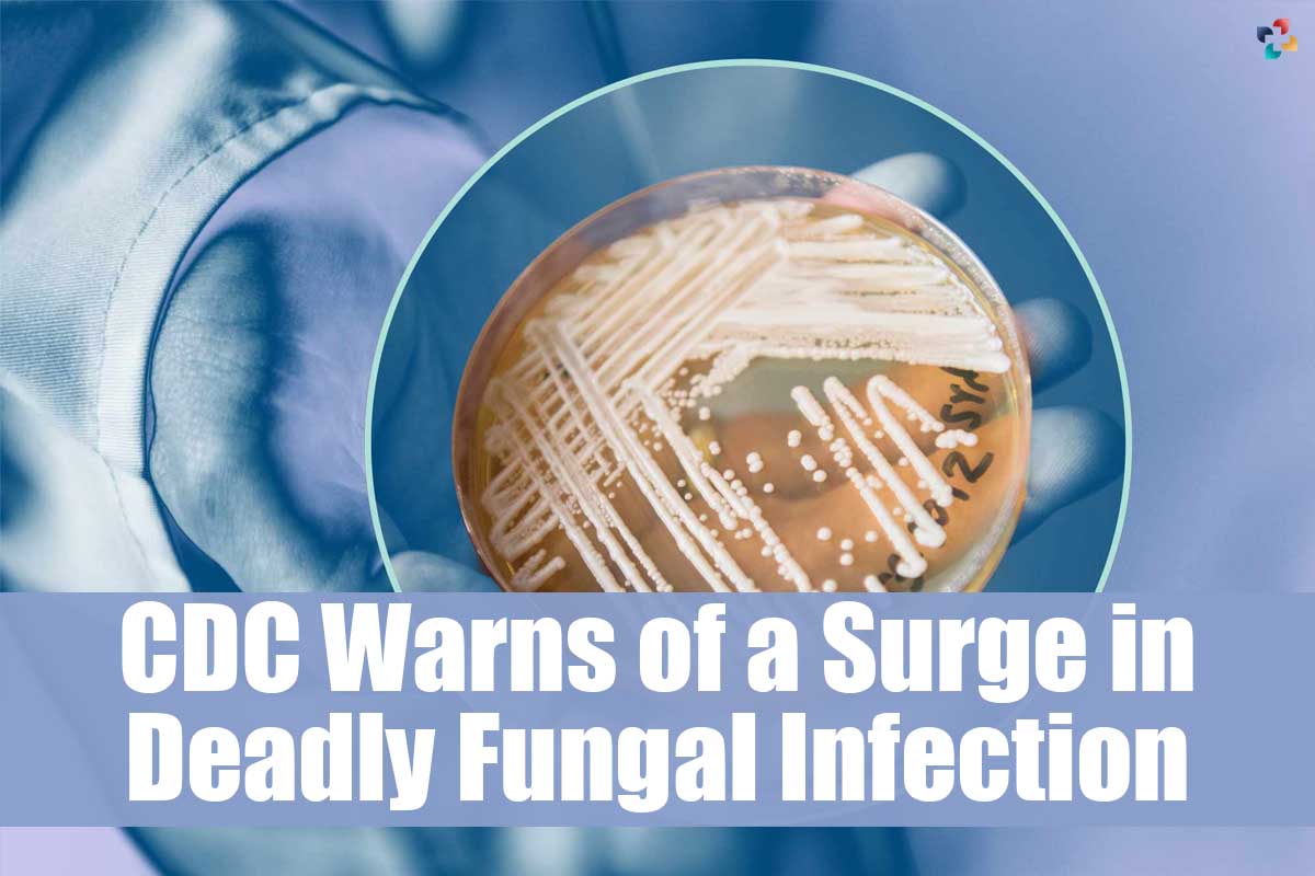 CDC Warns of a Surge in Deadly Fungal Infection | The Lifesciences Magazine