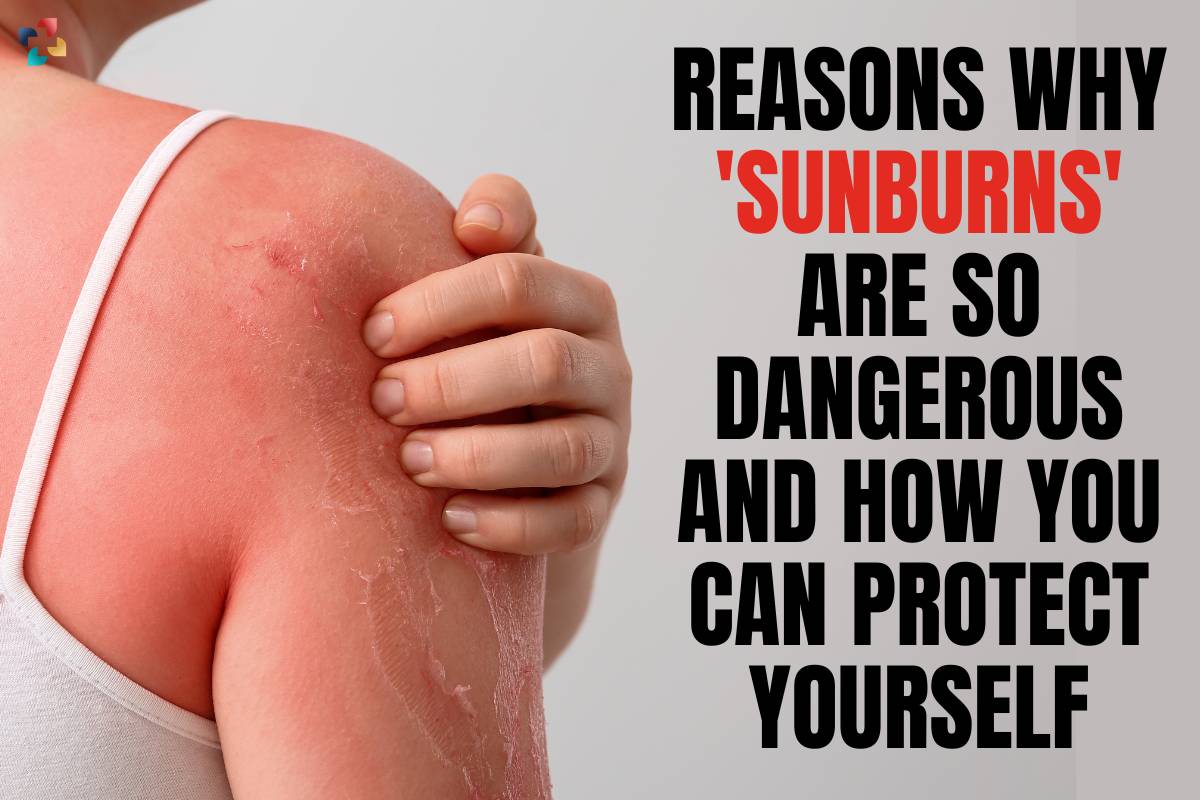 How you can protect yourself from sunburns? 8 Effective Methods | The Lifesciences Magazine