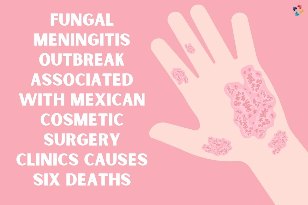 Fungal Meningitis Outbreak Associated with Mexican Cosmetic Surgery Clinics Causes Six Deaths | The Lifesciences Magazine