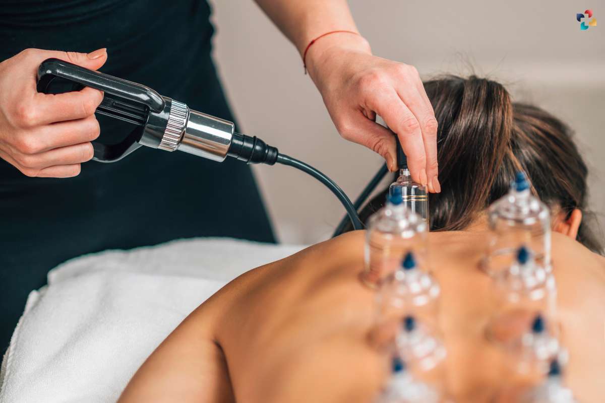 What Is Cupping Therapy, and Does It Work? 2 Important Types of cupping therapy | The Lifesciences Magazine