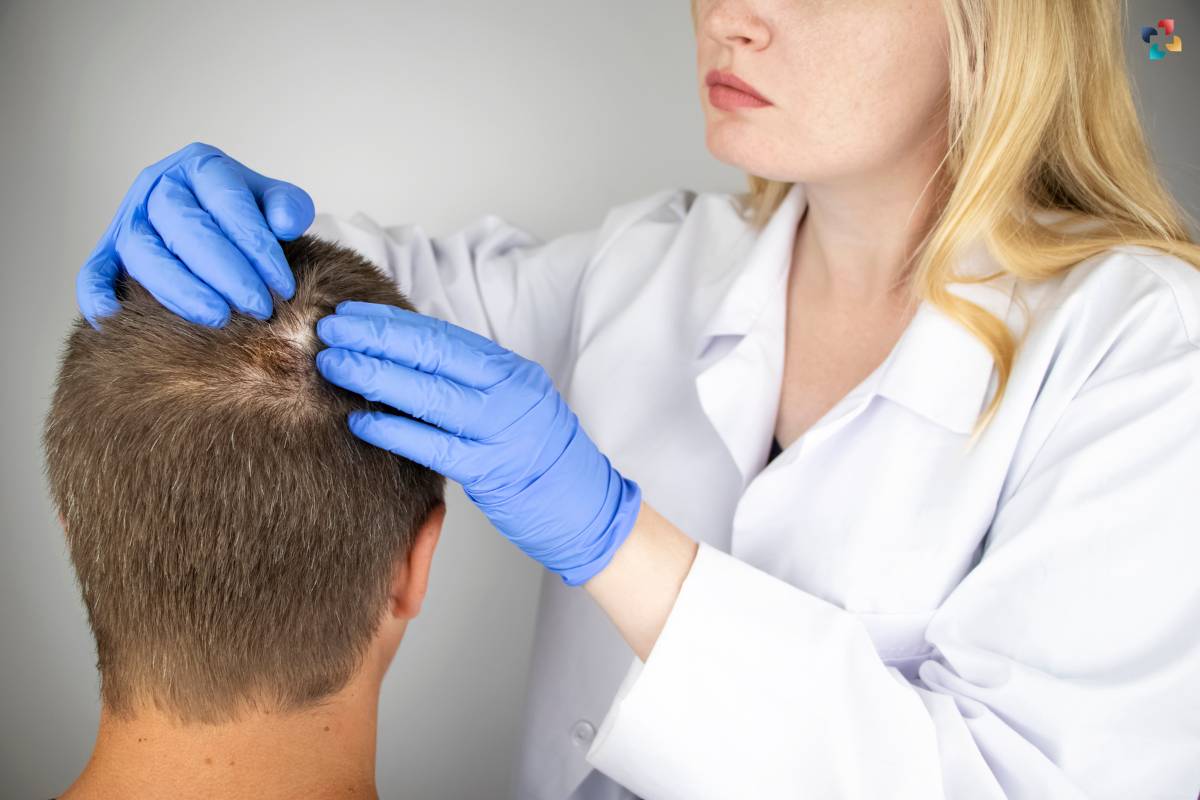 The Basics of Men's hair loss: 4 Best Remedies | The Lifesciences Magazine