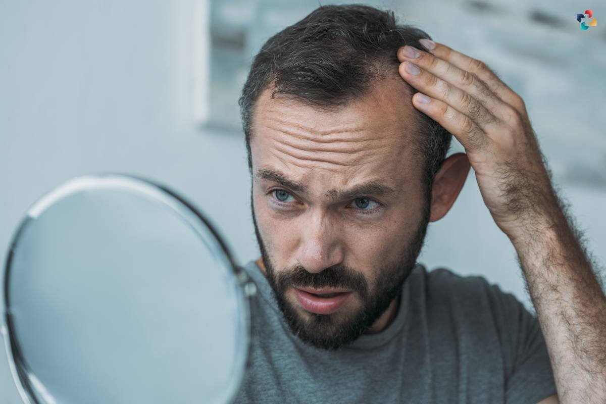 The Basics of Men's hair loss: 4 Best Remedies | The Lifesciences Magazine