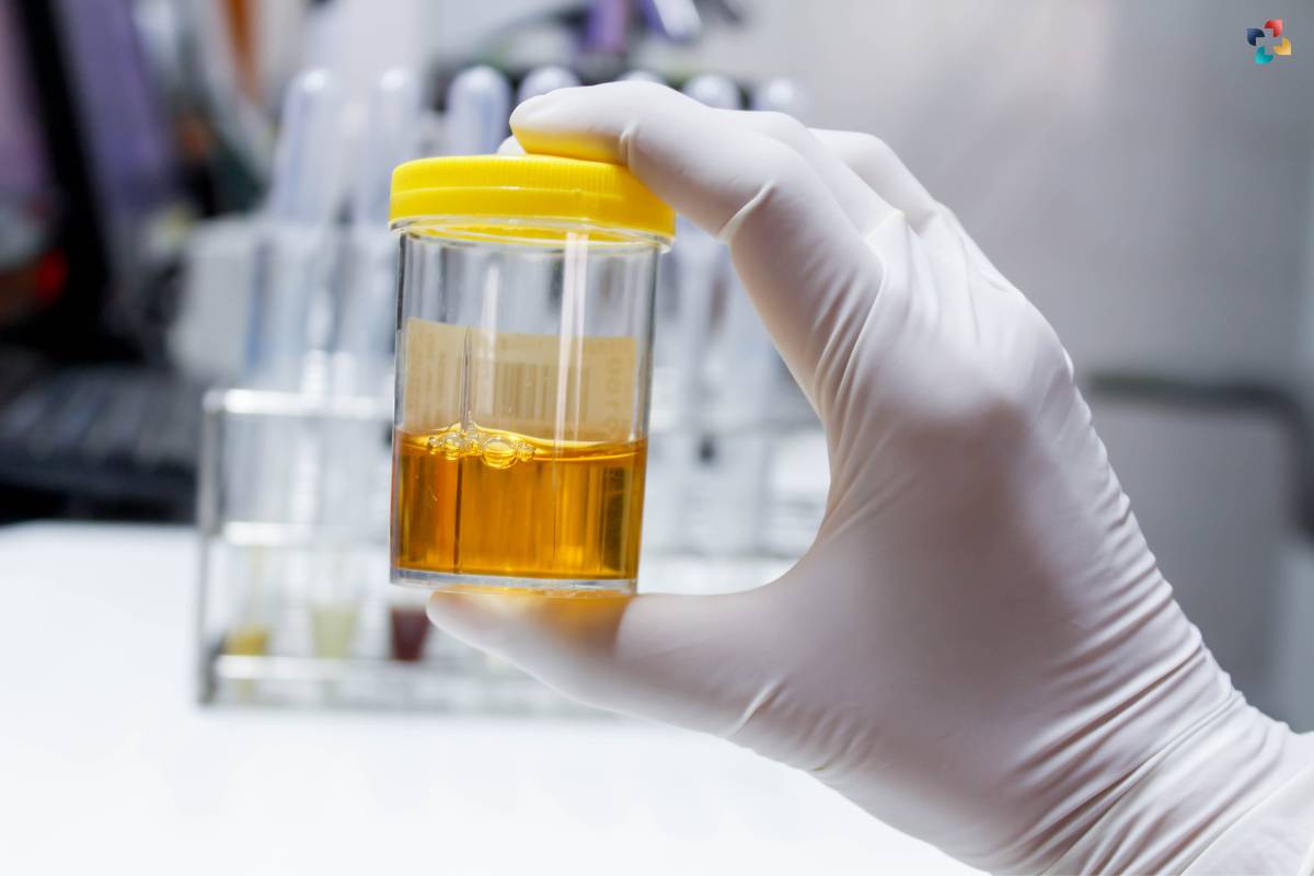 What Does the Color of Urine Mean? 7 Spectrum of Urine Color | The Lifesciences Magazine