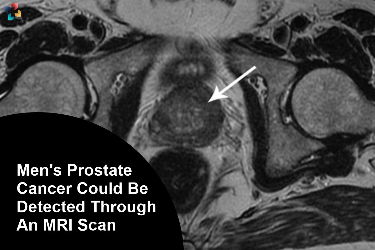 Men's Prostate Cancer Could Be Detected Through An MRI Scan | The Lifesciences Magazine