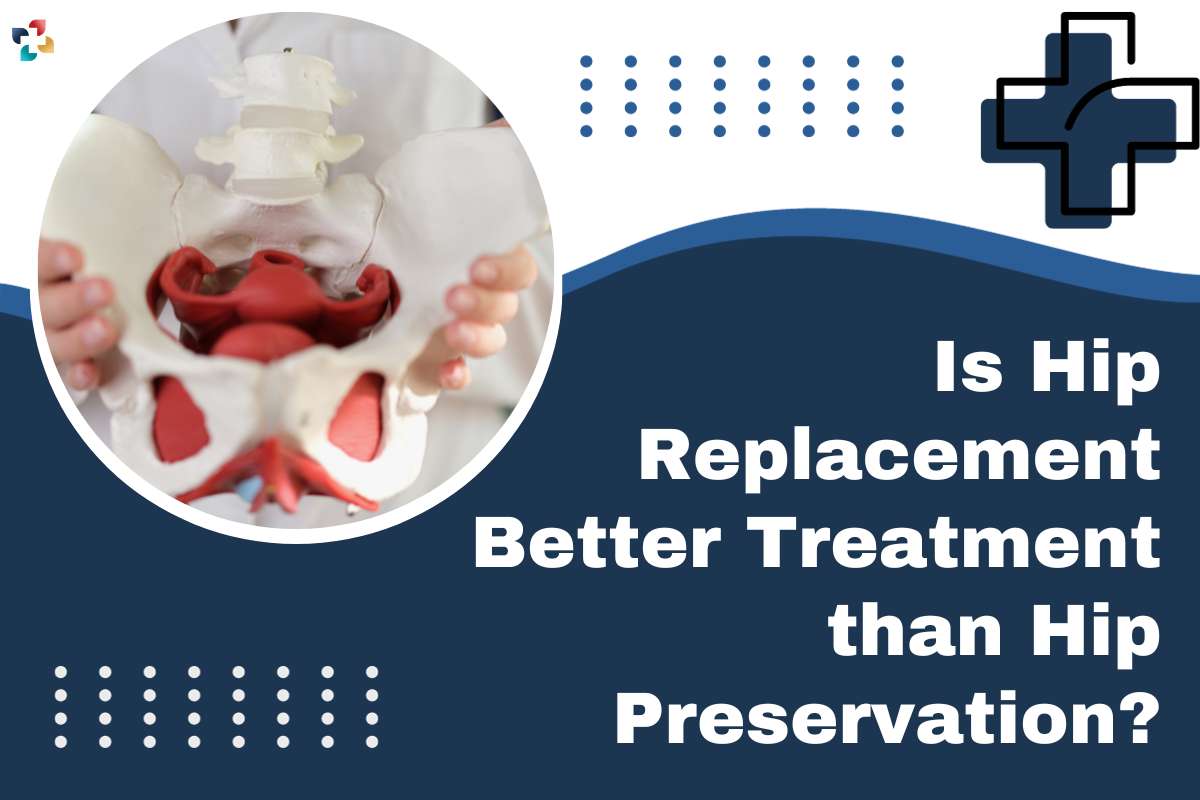 Is Hip Replacement Better Treatment than Hip Preservation? | The Lifesciences Magazine