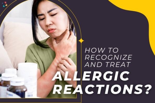 How To Recognize And Treat Allergic Reactions? Important Points | The ...