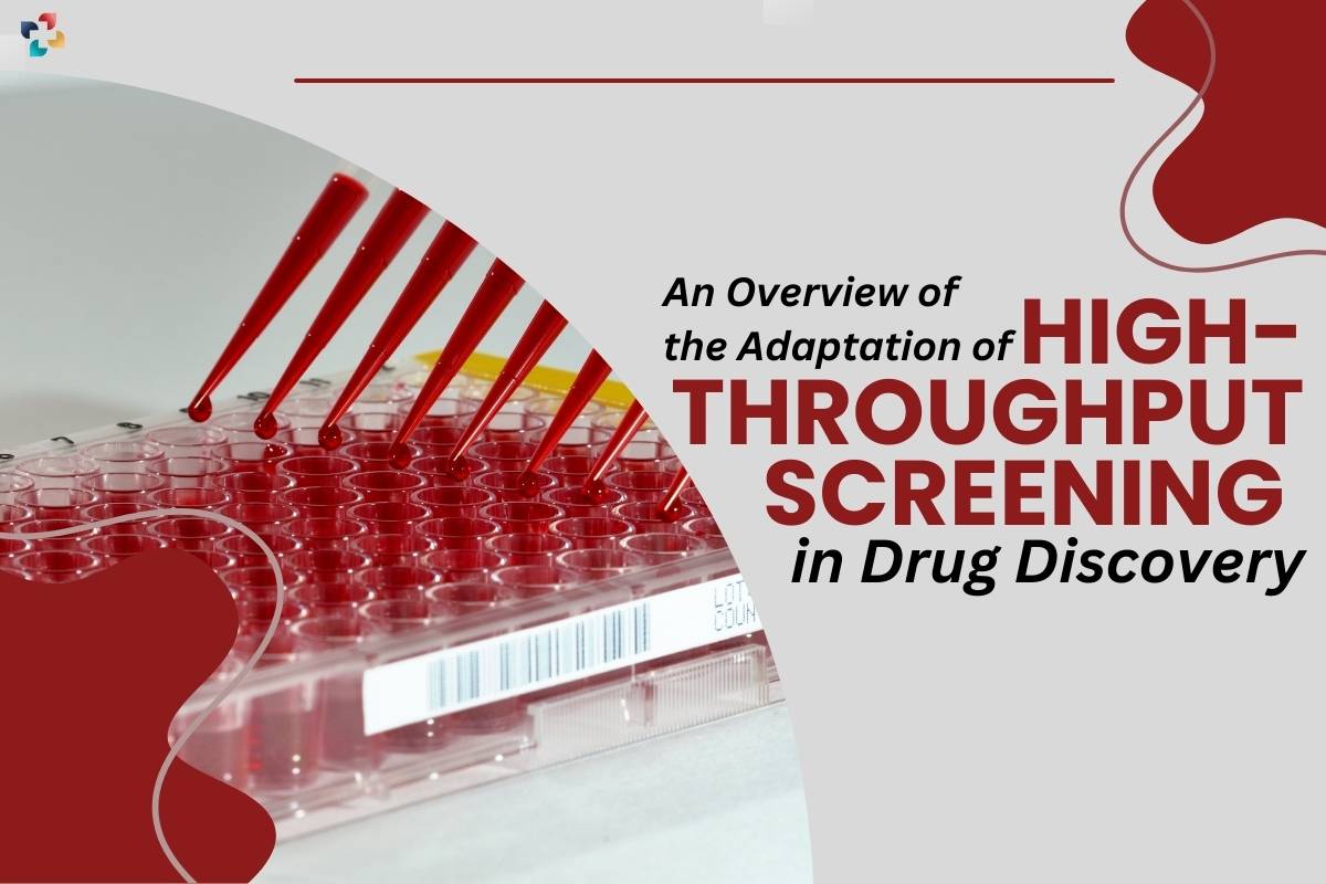 An Overview of the Adaptation of High-Throughput Screening in Drug Discovery | The Lifesciences Magazine