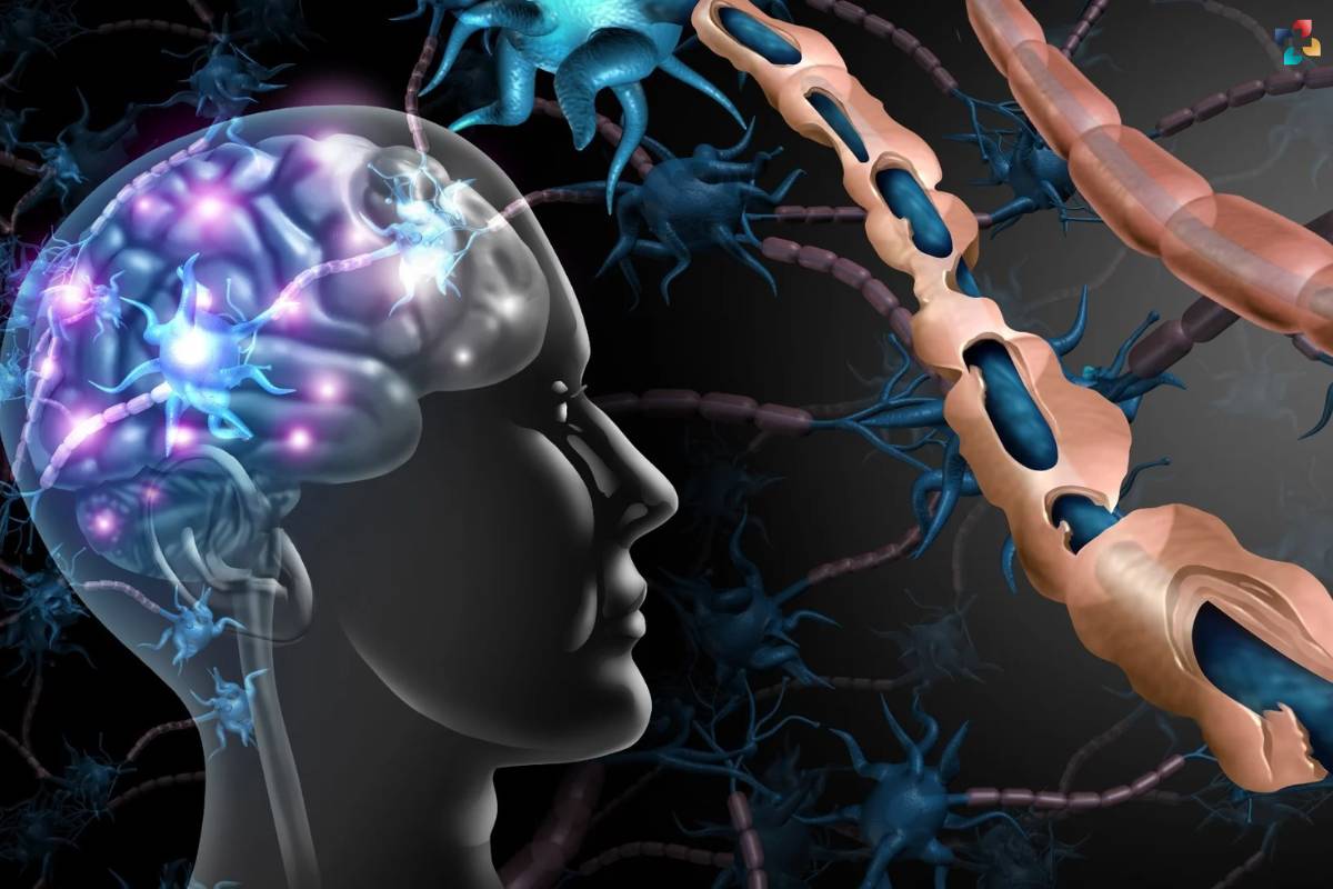 What is Multiple Sclerosis (MS)? Causes, Prognosis, and Management | The Lifesciences Magazine