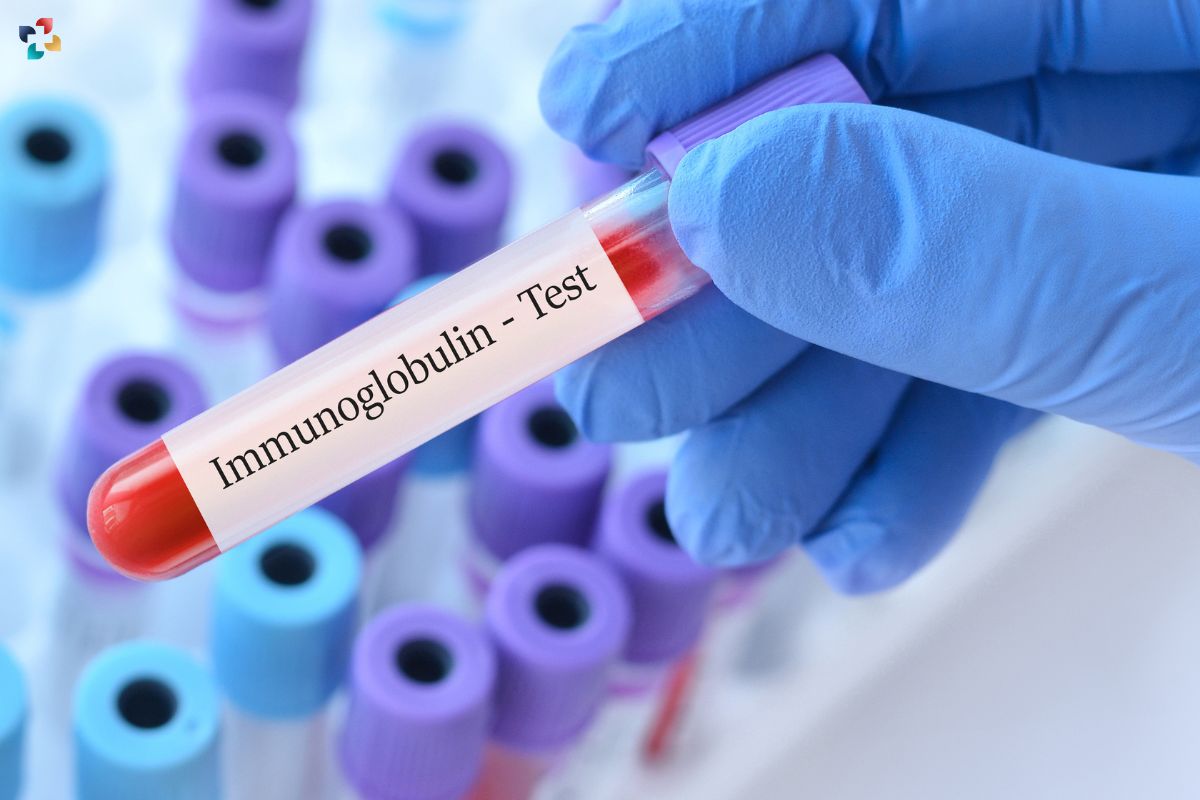 Immunoglobulin Test: Impact of High Immunoglobulin Levels (IgA) | The Lifesciences Magazine