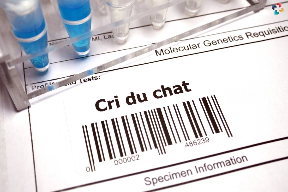 Cri du Chat Syndrome: Causes, Symptoms, and Management | The Lifesciences Magazine