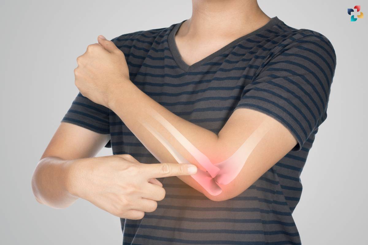 Bone Growth Stimulators: A Guide to Non-Surgical Healing Acceleration