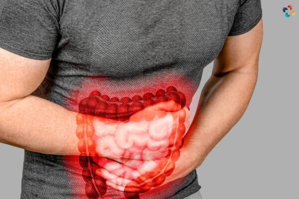 Irritable Bowel Syndrome (IBS): Causes, Symptoms, And Management ...