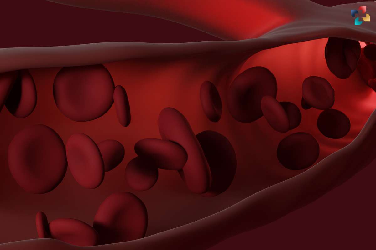 Red Cell Distribution Width: Importance, Interpretation, and Clinical Significance | The Lifesciences Magazine