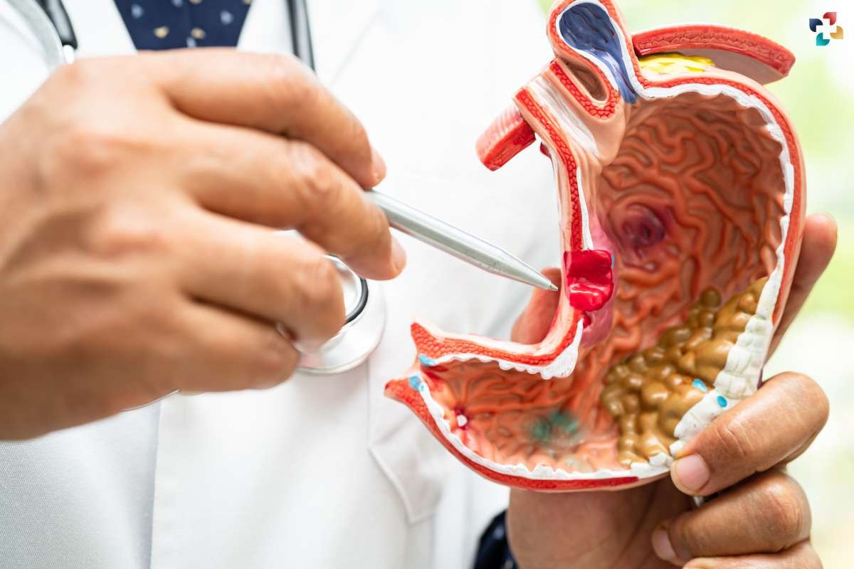 Gastrointestinal Diseases: Causes, Symptoms, and Treatment Options | The Lifesciences Magazine