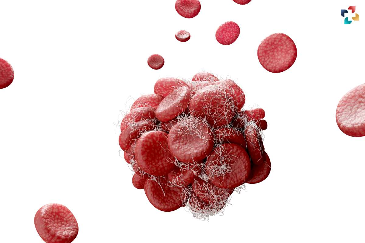 Red Cell Distribution Width: Importance, Interpretation, and Clinical Significance | The Lifesciences Magazine