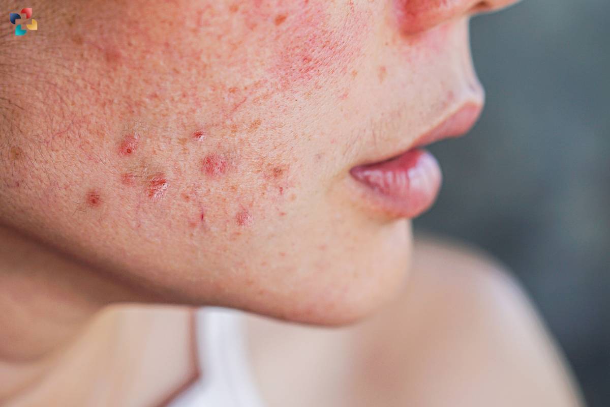 Red Spots On The Skin: Causes, Symptoms, And Treatment Options