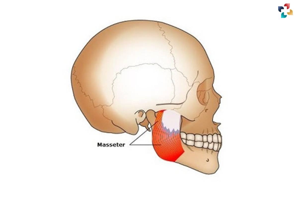 Masseter Muscle Masseter Muscle