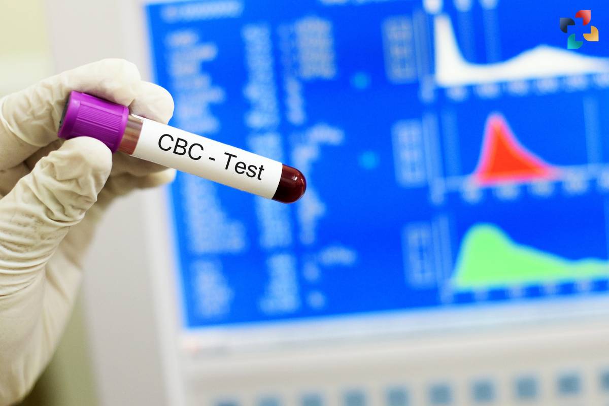 Importance of CBC with Differential in Healthcare | The Lifesciences Magazine