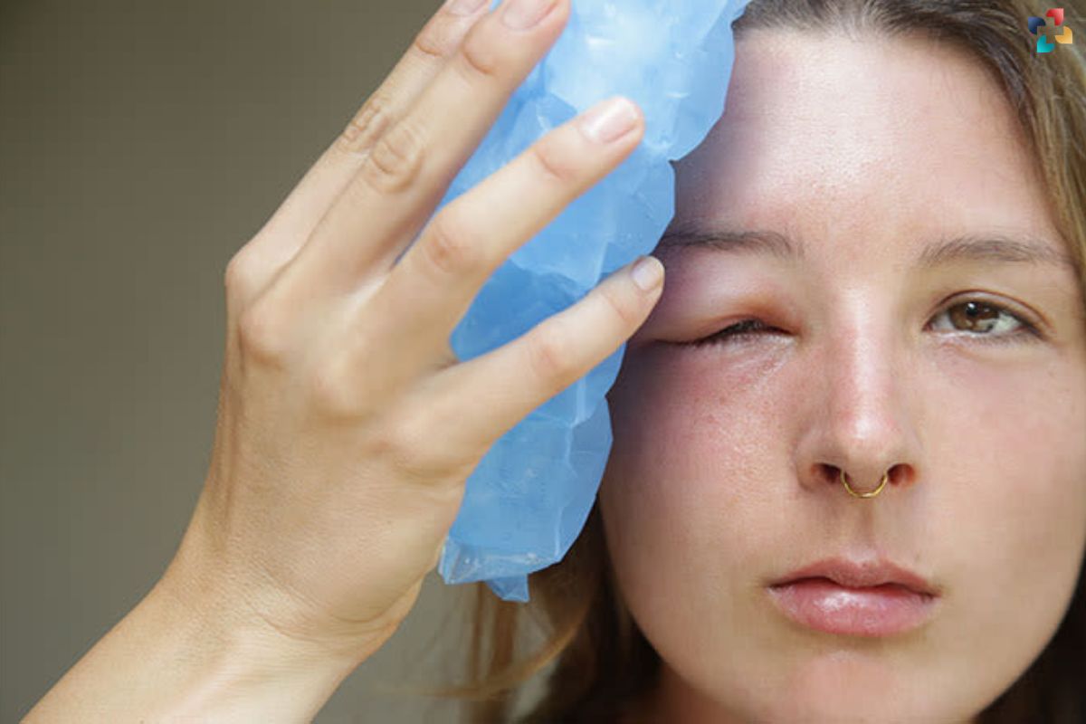 Understanding Swollen Eyelids: Causes, Symptoms, and Best Treatment Options | The Lifesciences Magazine