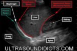 Abdominal Quadrants: Anatomy, Function, And Clinical Significance | The ...