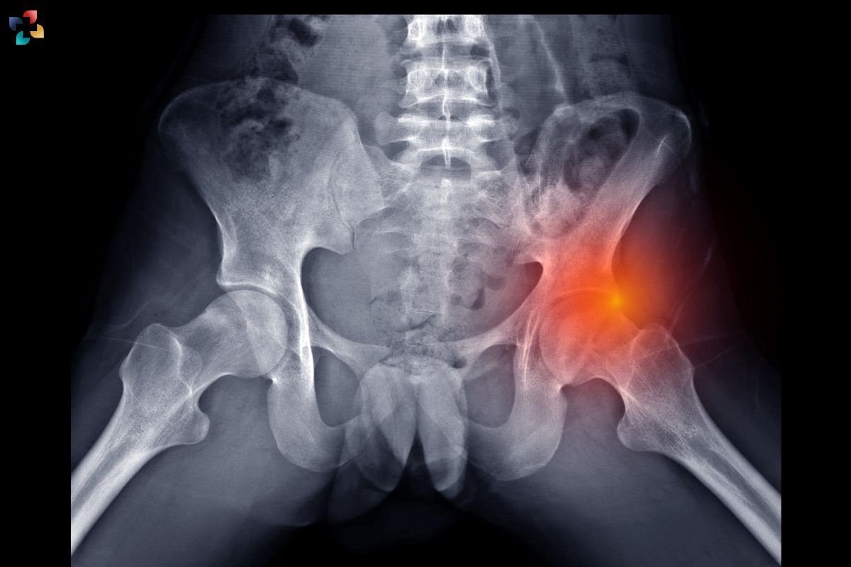 Hip Flexor Pain: Anatomy, Causes, Symptoms, Diagnosing and Treatment Options | The Lifesciences Magazine