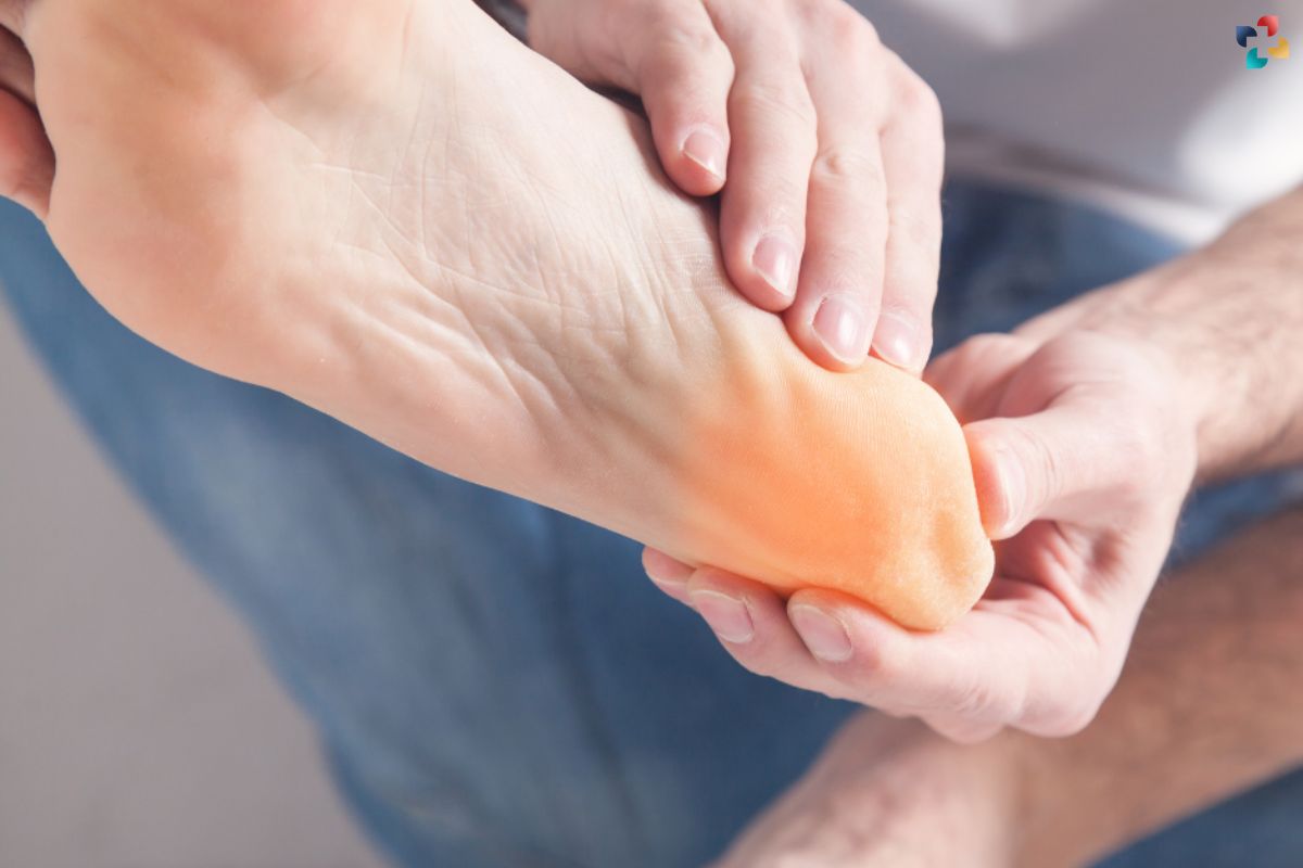 Bone Spurs on Feet: 7 Causes, Symptoms, Treatment, and Prevention | The Lifesciences Magazine