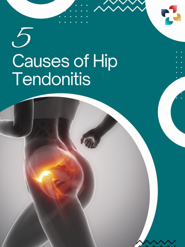 5 Causes of Hip Tendonitis | The Lifesciences Magazine