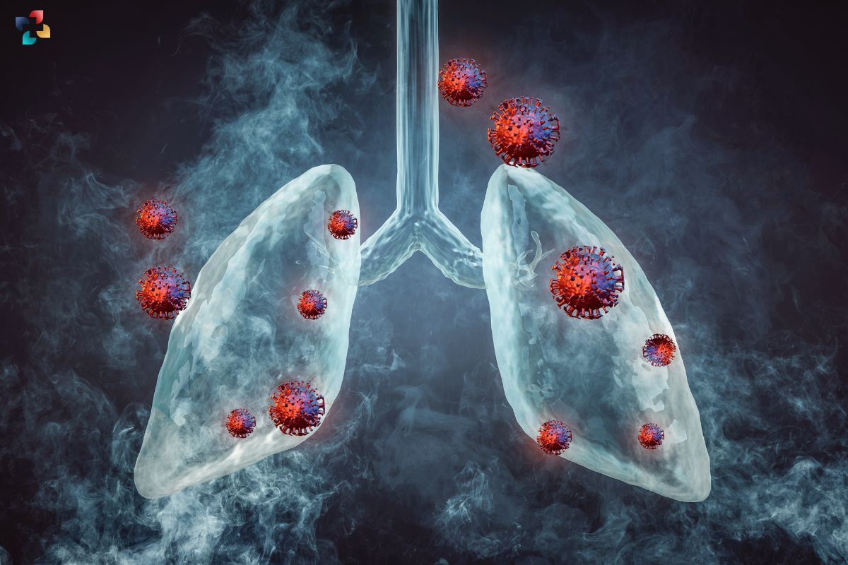 The Role of Immunotherapy for Lung Cancer | The Lifesciences Magazine