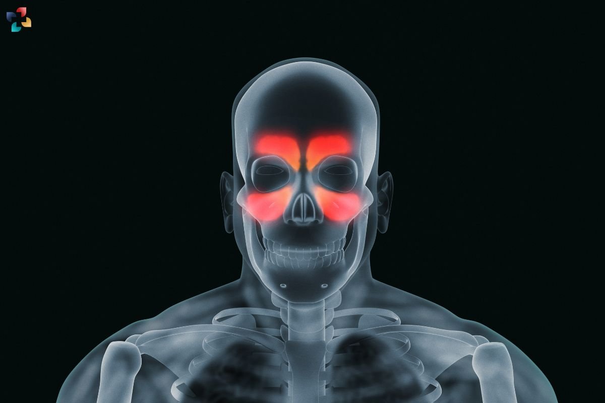 Understanding and Managing Sinus Headaches: A Comprehensive Guide | The Lifesciences Magazine