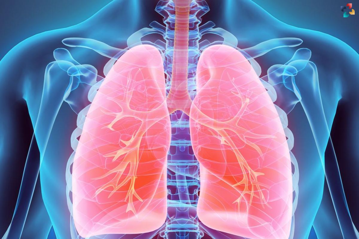 Advanced Lung Cancer Treatment Shows Promising Results with Novel Combination Therapy | The Lifesciences Magazine