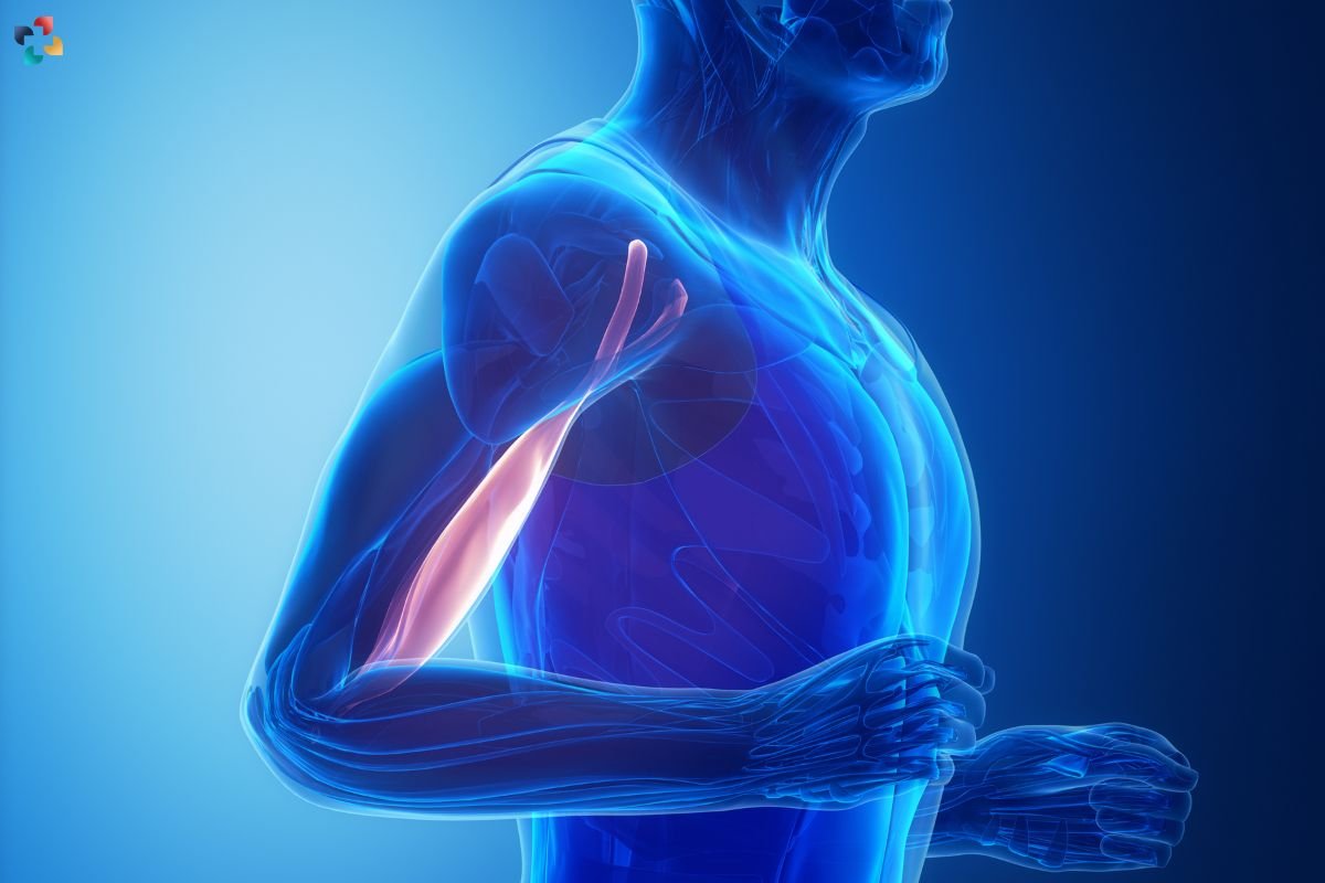 Distal Biceps Tendonitis: Causes, Symptoms, Diagnosing, and Treatment | The Lifesciences Magazine