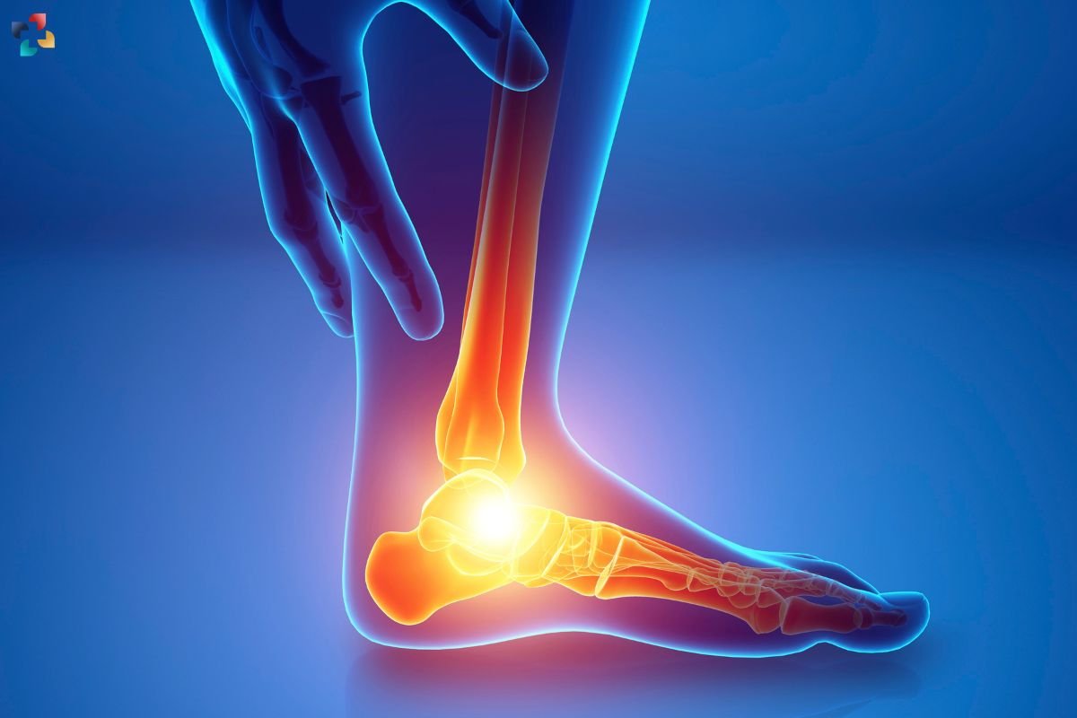 Calcaneal Stress Fracture: Causes, Symptoms & Treatment | The Lifesciences Magazine