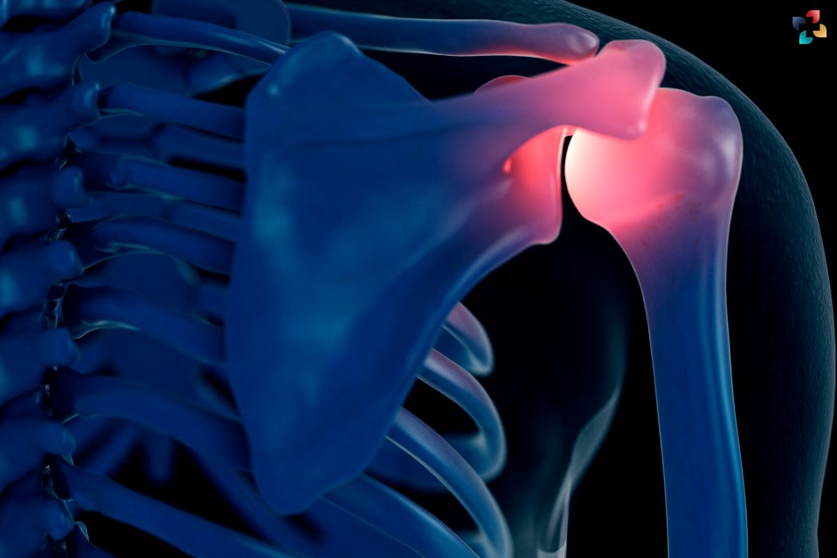 Glenoid Labrum Tear (Shoulder Joint Tear): Symptoms, Causes, Treatment, and Recovery | The Lifesciences Magazine