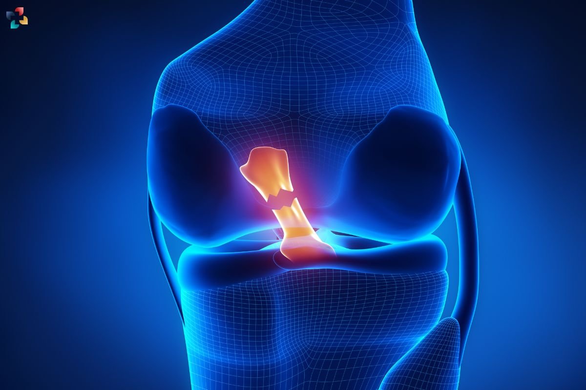 20 Effective Exercises for Meniscus Tear Rehab | The Lifesciences Magazine