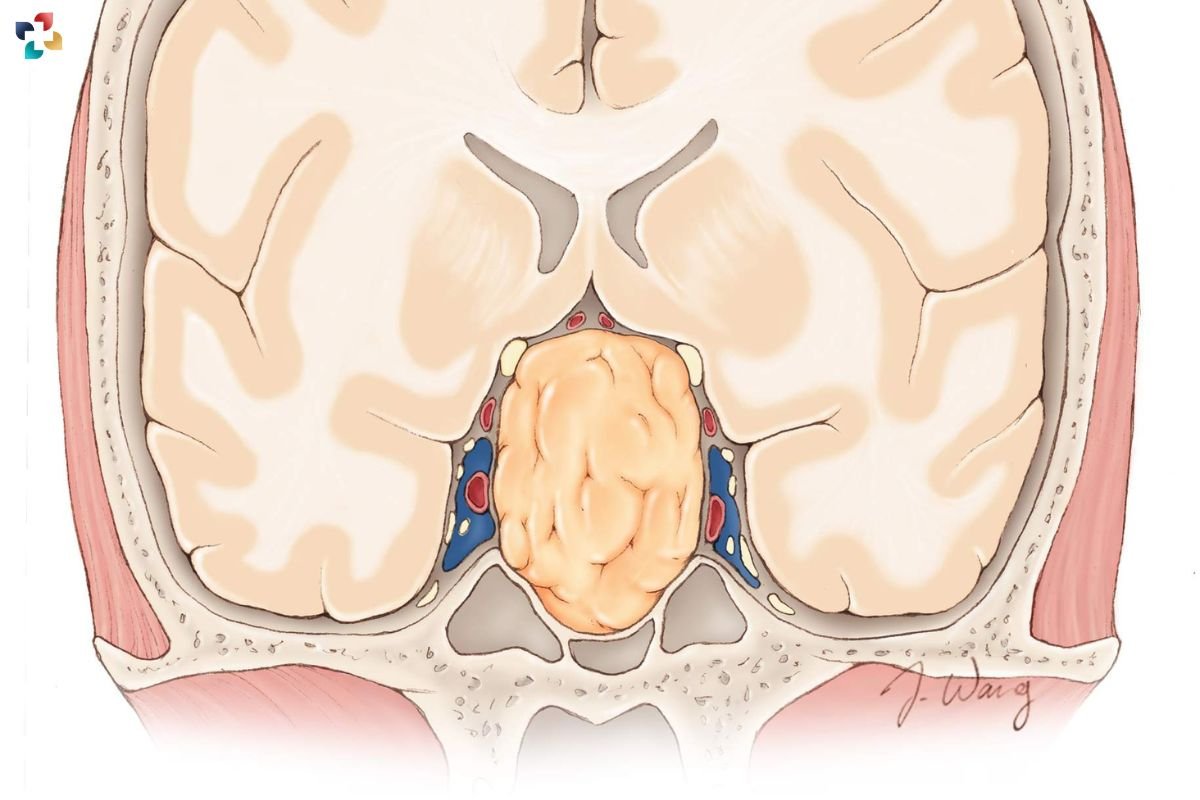 Disorders of the Pituitary: Types, Symptoms, Causes, Diagnosis, and Treatment | The Lifesciences Magazine