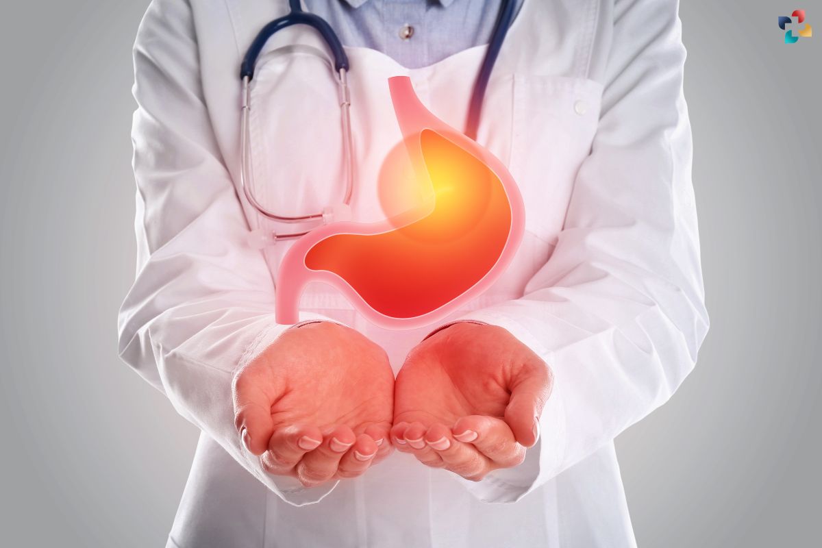Exercise-Related Heartburn: Causes, Symptoms, Prevention, and Management | The Lifesciences Magazine