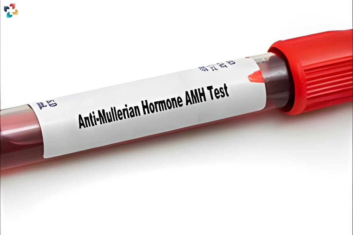 Accurate Information Reduces Interest in Anti-Mullerian Hormone Testing | The Lifesciences Magazine