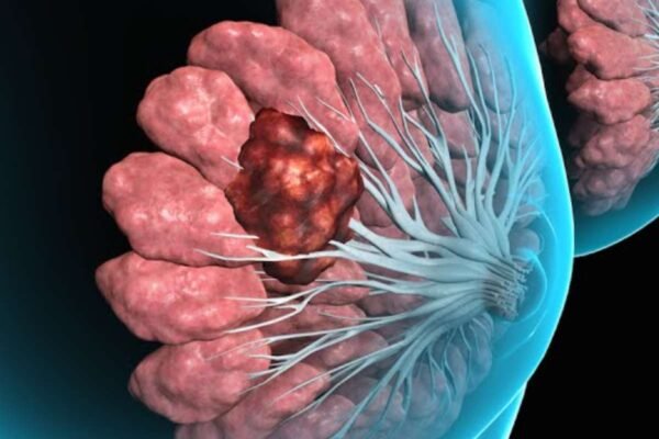 Minimally Invasive Biopsy: Revolutionizing Diagnostic Medicine | The ...