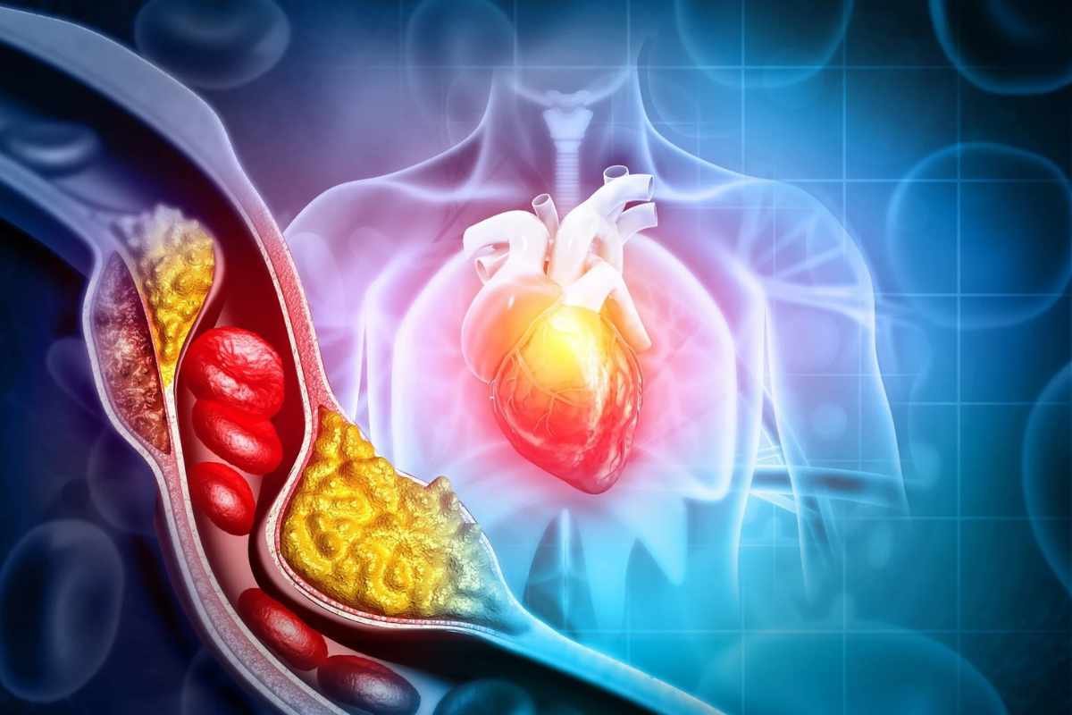 Early Cholesterol Fluctuations Found to Drive Atherosclerosis Development | The Lifesciences Magazine