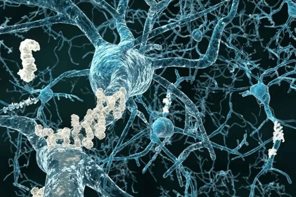 Carotenoid Phytoene May Slow Alzheimer's Disease Plaque Formation | The Lifesciences Magazine