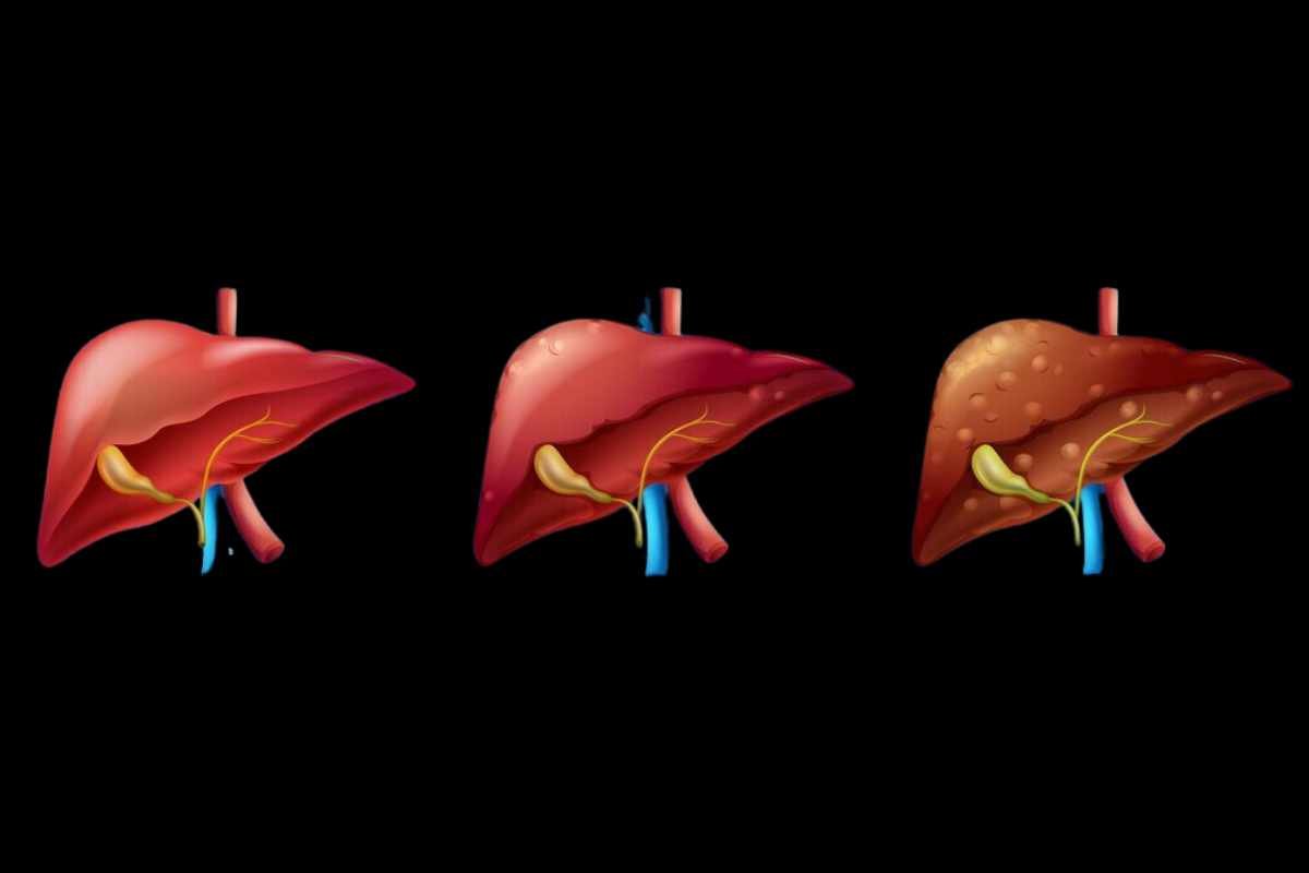 New Hydrogen Sulfide Therapy Shows Promise in Combating Obesity | The Lifesciences Magazine