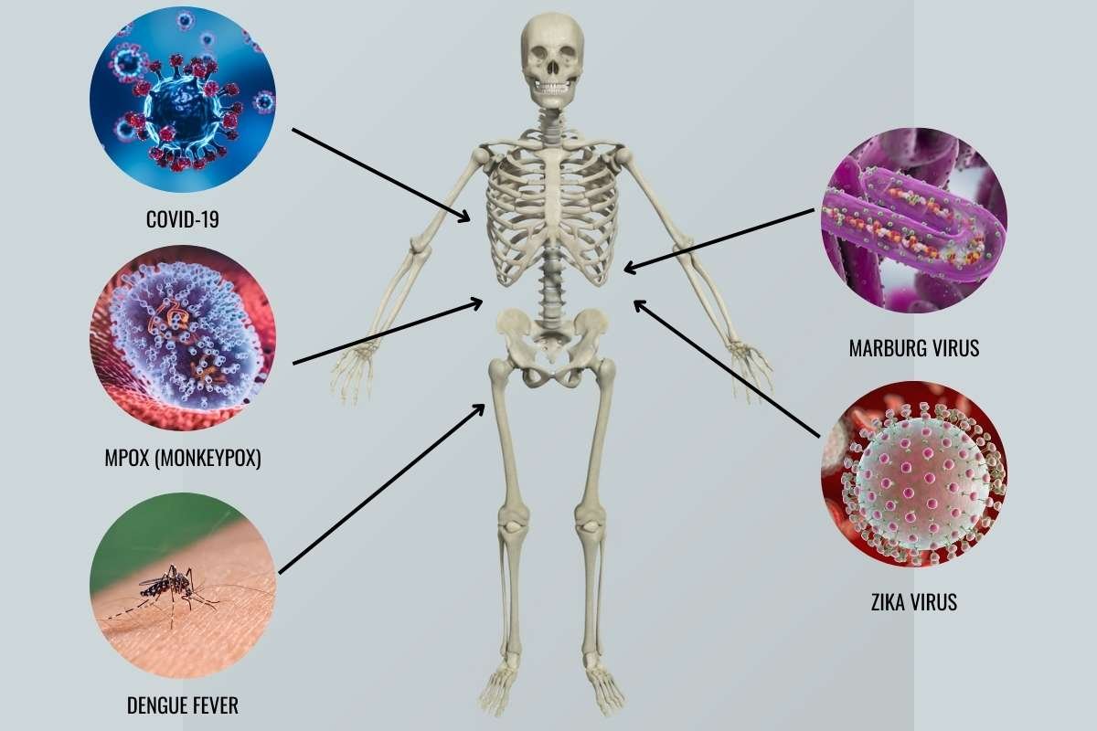 New Infectious Diseases: A-Z Ultimate Guide (up to date) | The Lifesciences Magazine