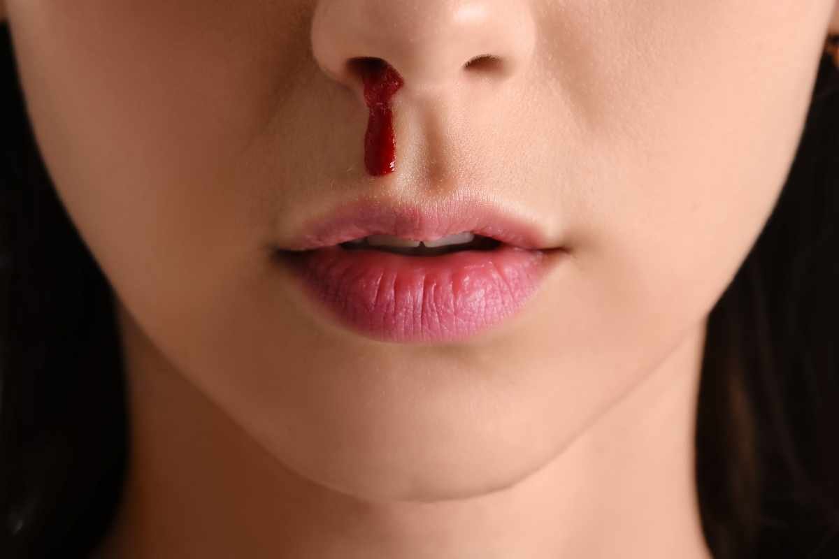 When to Worry About Nosebleeds_ Signs You Shouldn’t Ignore!