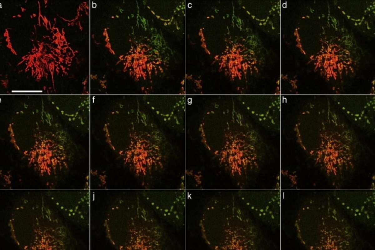 Tetramethylrhodamine Methyl Ester(Mitochondrial Mysteries) | The Lifesciences Magazine