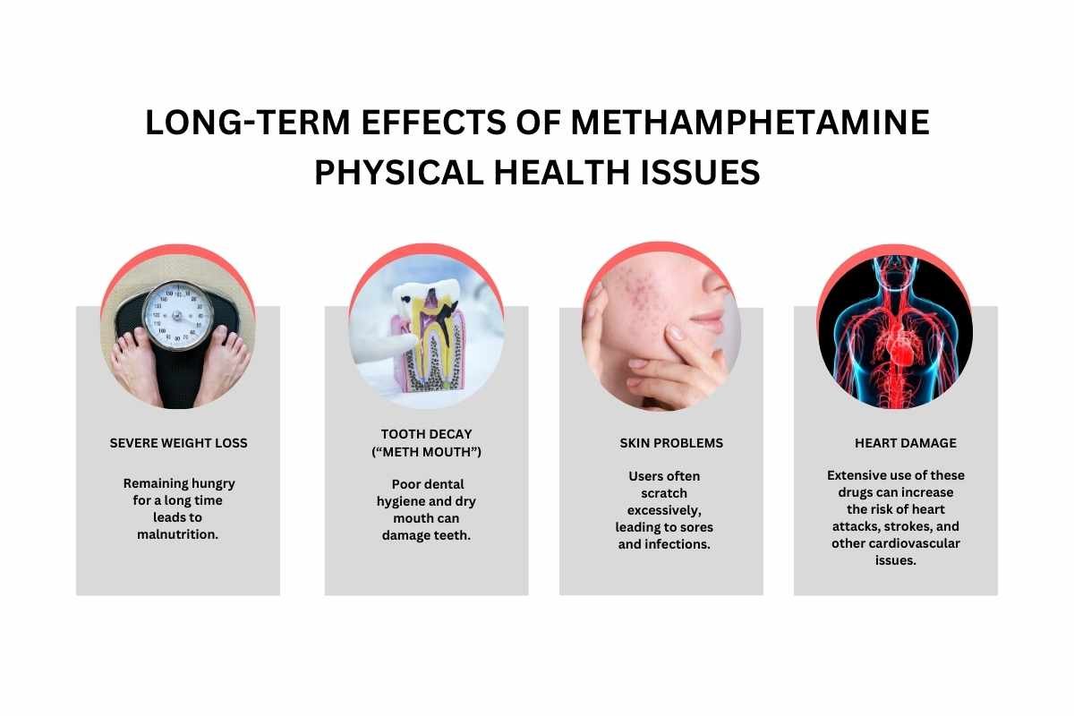 Treatments and Effects of Methamphetamine | The Lifesciences Magazine