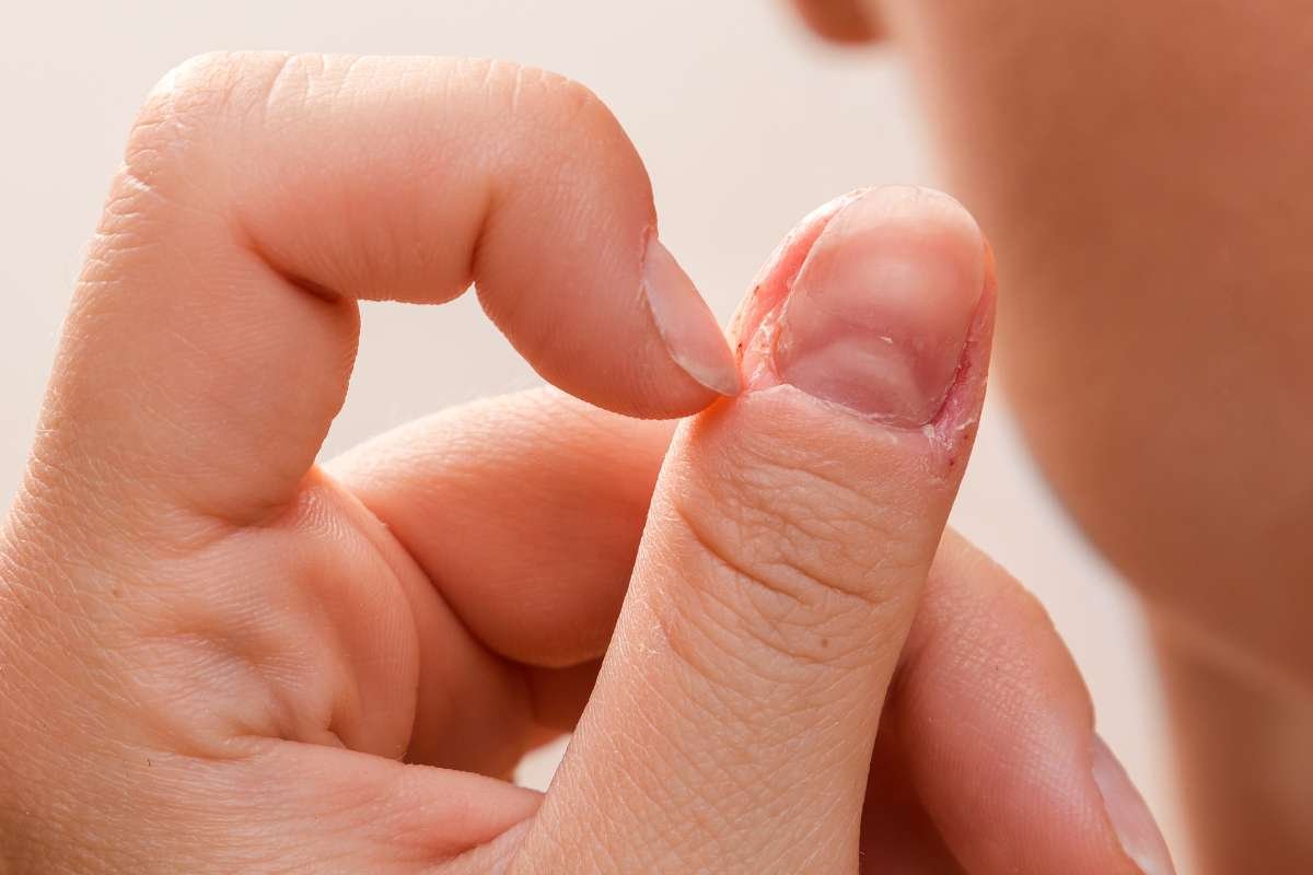 Why is My Toenail Growing at an Angle? Find Out the Fixes | The Lifesciences Magazine