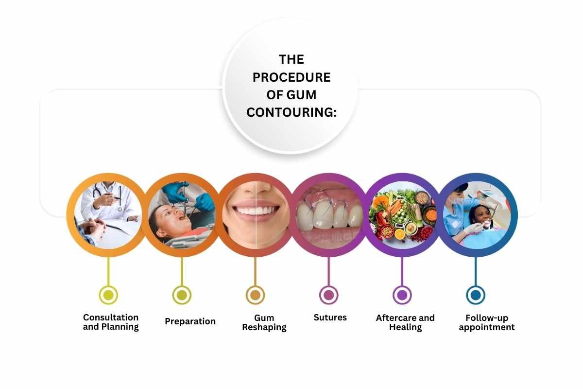 Gum Contouring: Achieve a Perfect, Confident Smile! | The Lifesciences Magazine